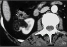 Case Diagnosis