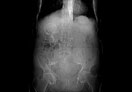 Case Diagnosis