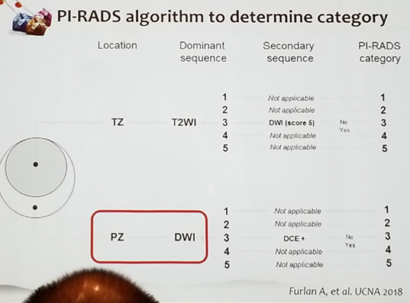 PIRAD algorithm in mpMRI to determine category of lesion