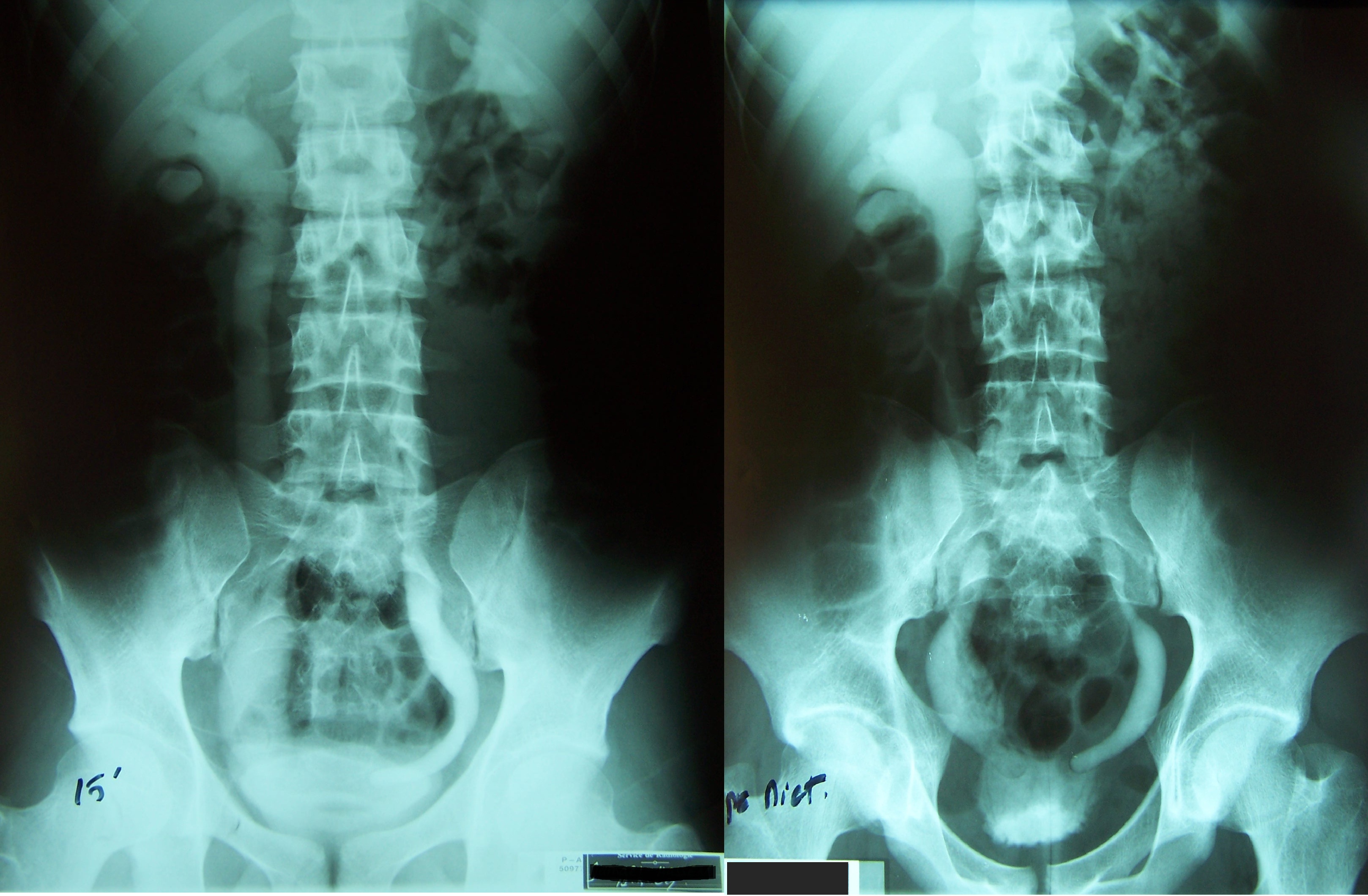 Case 13 fig 1