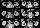 Case Diagnosis
