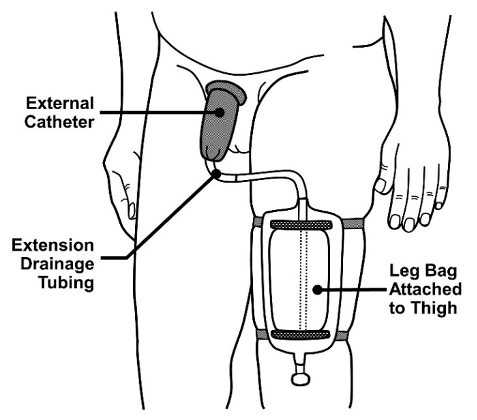 external urinary catheters