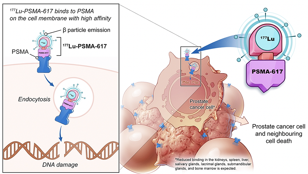 immunotherapy for prostate cancer 2022 volume prostata