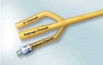 3 Way Indwelling Catheter