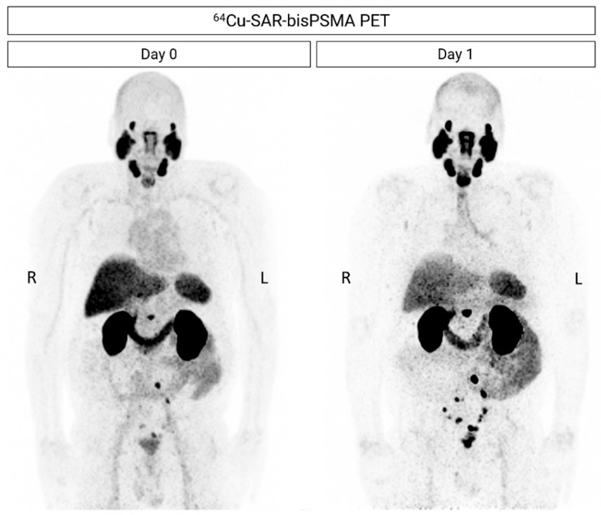 64Cu-SAR-bisPSMA_Clarity.jpeg