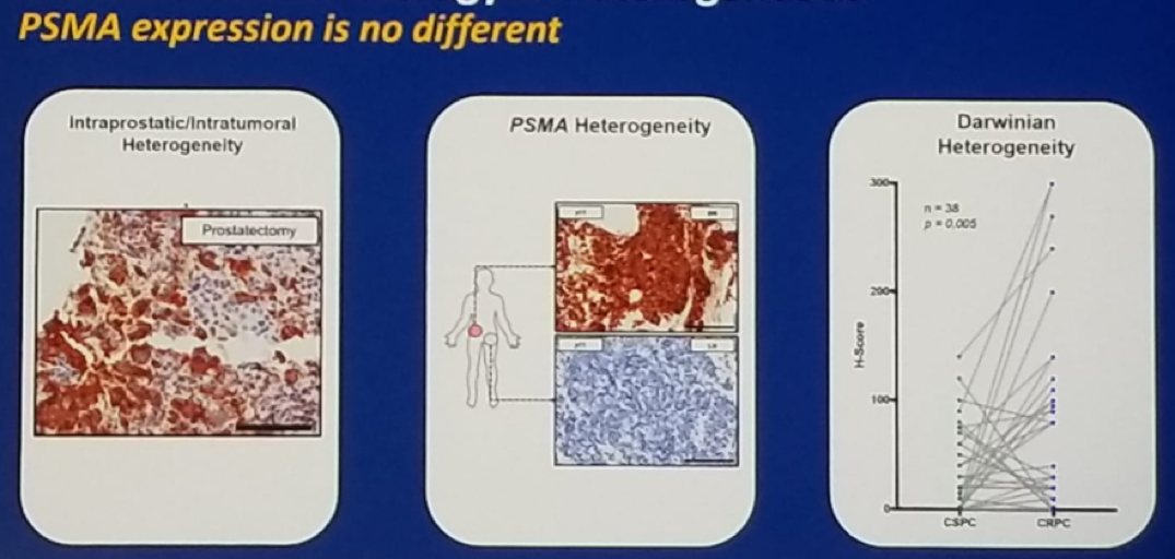 ASCO2019_PSMA_expression.png