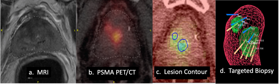 AUA_PETCT.png
