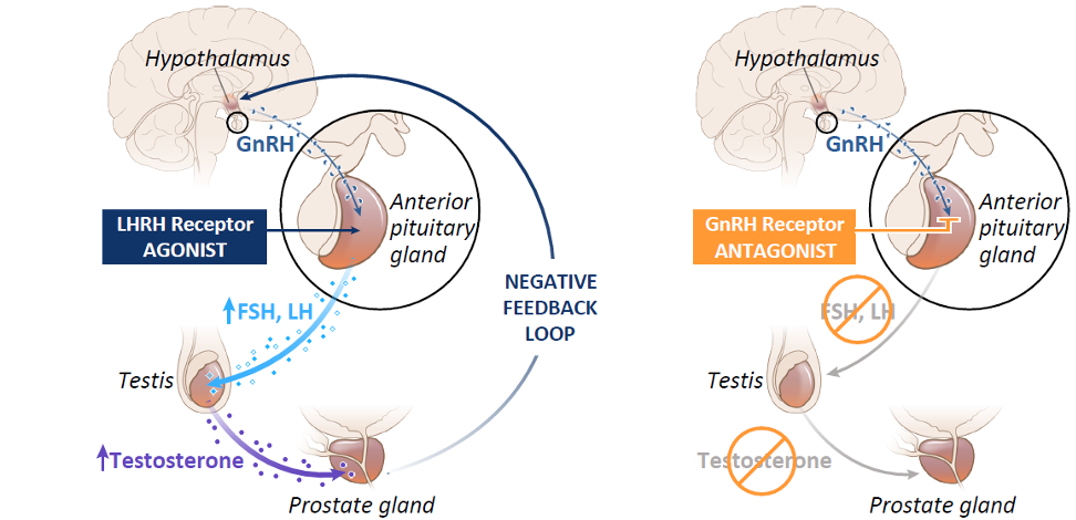 Androgen deprivation therapy