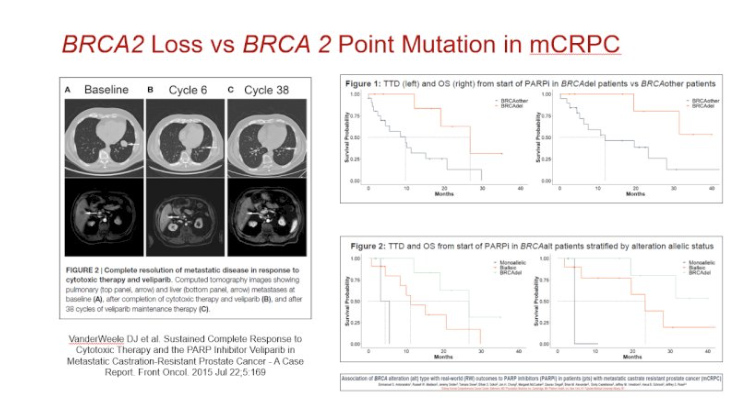 BRCA2