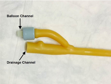 Urinary Catheter Size Chart