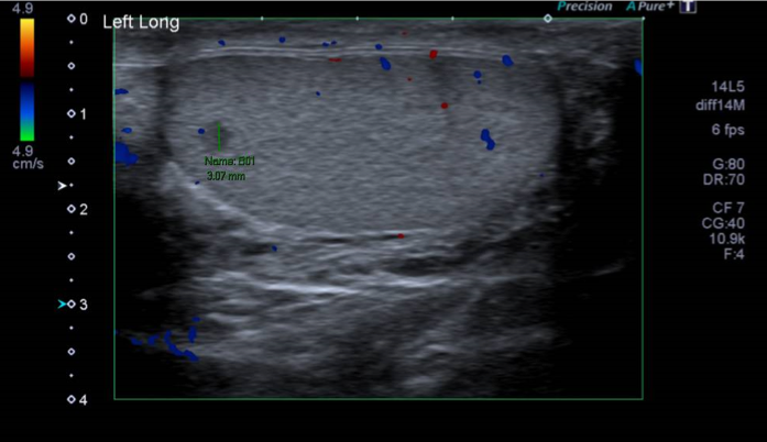 Interval_ultrasound_scan.png