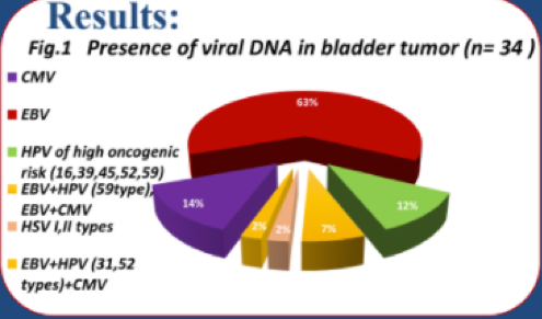 Latent Viral Infection as a Factor Of Unfavorable Prognosis of Bladder Cancer