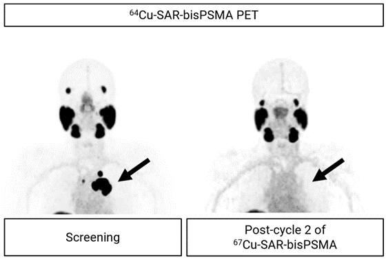 PET_images_figure.png