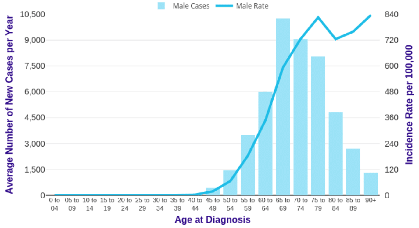 Prostate Cancer Age at Diagnosis