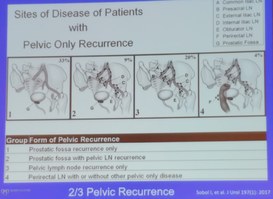 SIU_2019_pelvic_only_recurrence.png