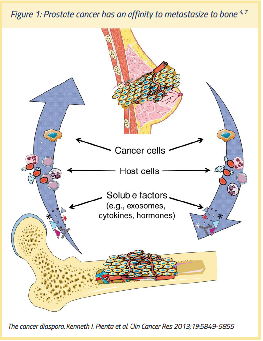 secondary prostate cancer)