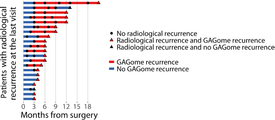 Swimmer_plot_for_the_21_patients_with_radiological_recurrence.jpeg
