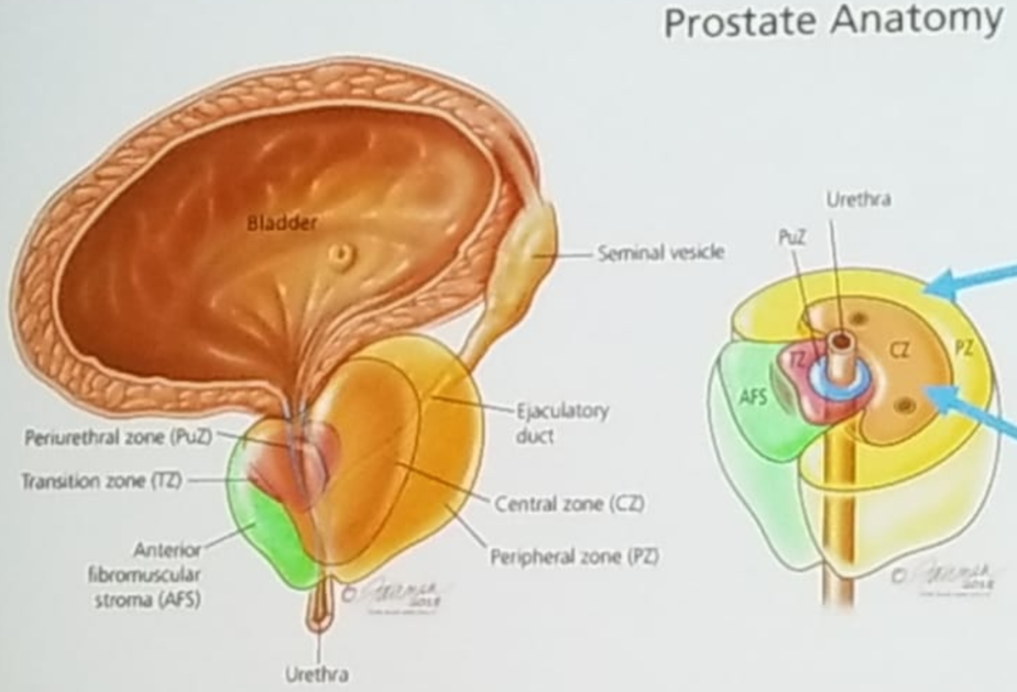 UroToday_ASCOGU2019-prostateanatomoy.png