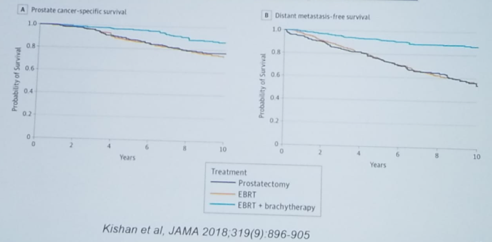 UroToday CUOS19 External Beam Radiotherapy with Brachytherapy Boost 