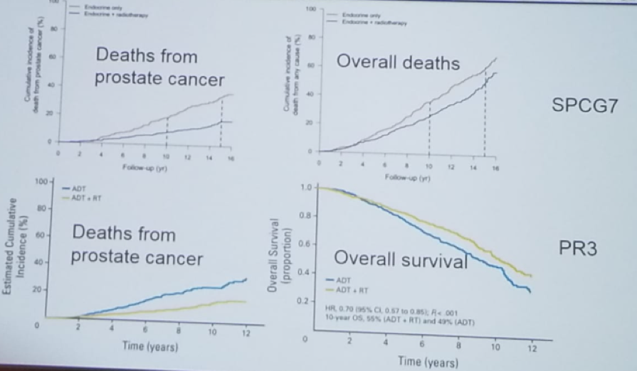 UroToday CUOS19 Older Methods of Radiation Improve Survival in Prostate Cancer Patients