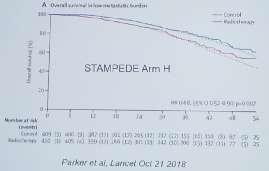 UroToday CUOS19 Radiotherapy Improves Survival in Patients With Low Burden Metastatic Prostate Cancer