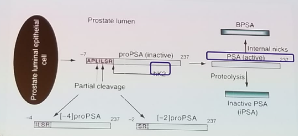 UroToday EAUPCa18 PSA production