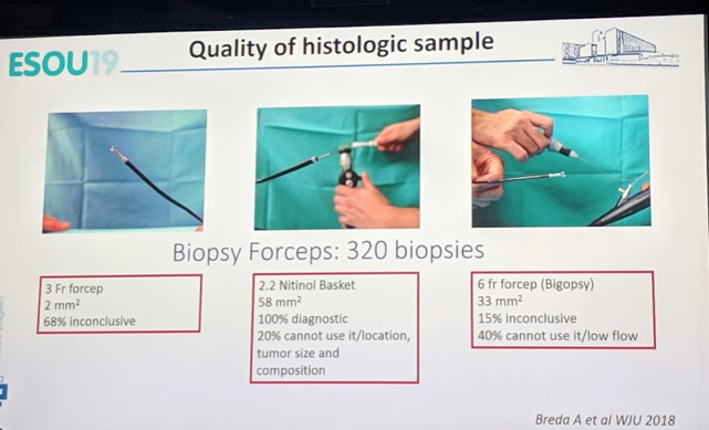 UroToday ESOU19 quality of histological example