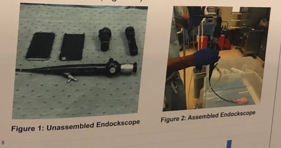 UroToday WCE2018 Endoscope disassembled and in use