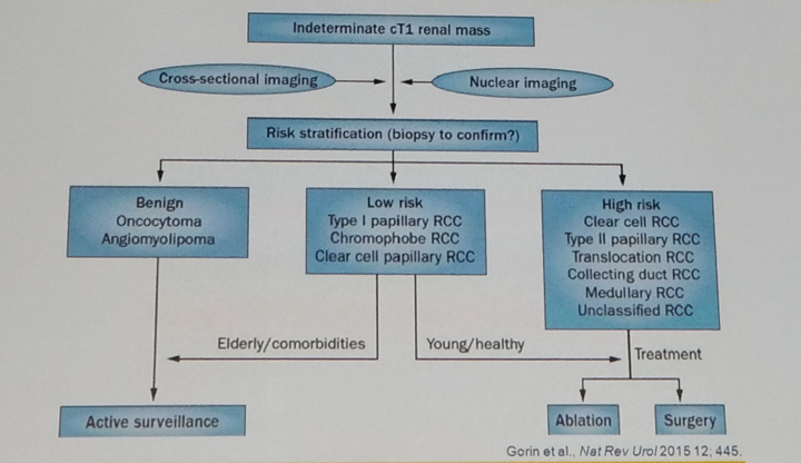 UroToday WCE2018 Proposed algorithm for active surveillance