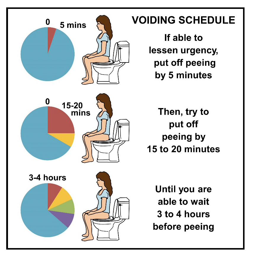 https://www.urotoday.com/images/Voiding_Schedule.png