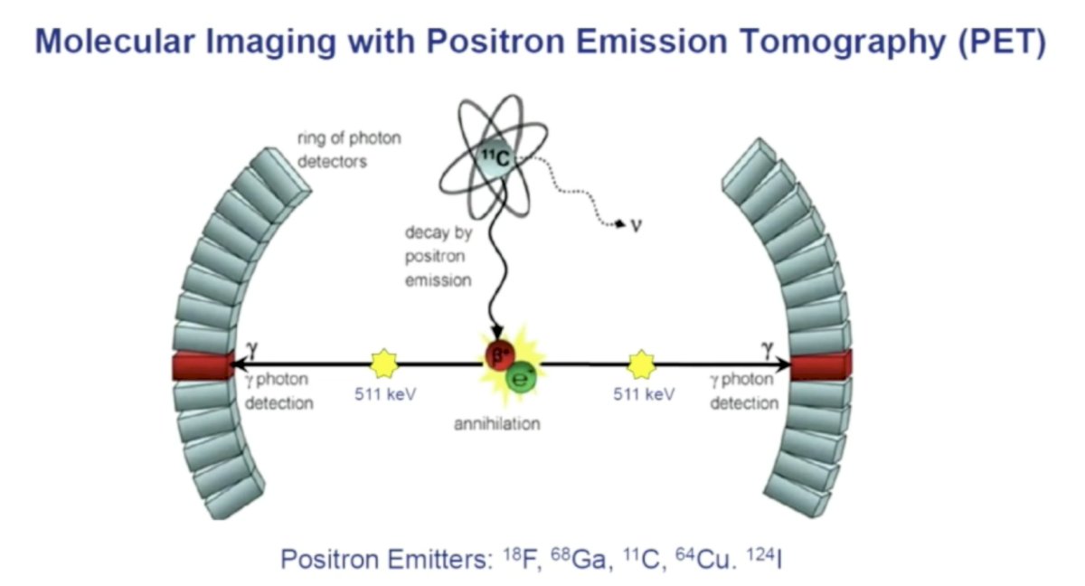 PSMA-targeted PET-2.jpg