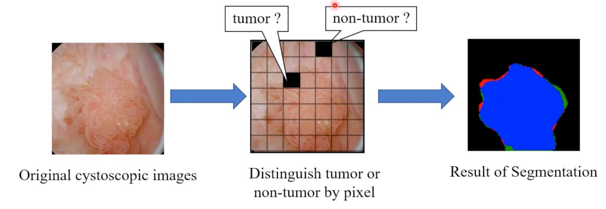 tumor images.jpg