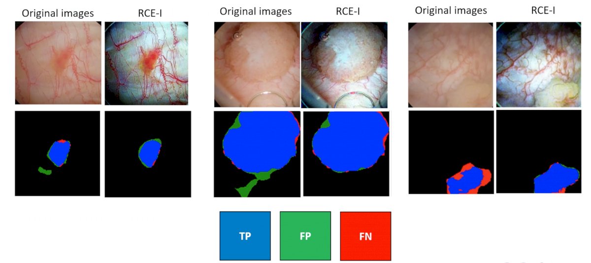 color imaging