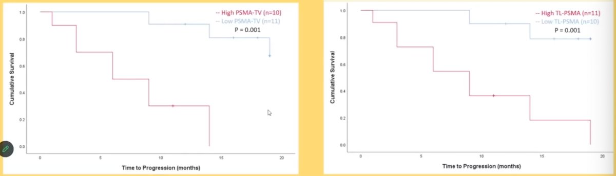High TL PSMA comparison