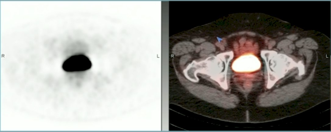 transverse slice image