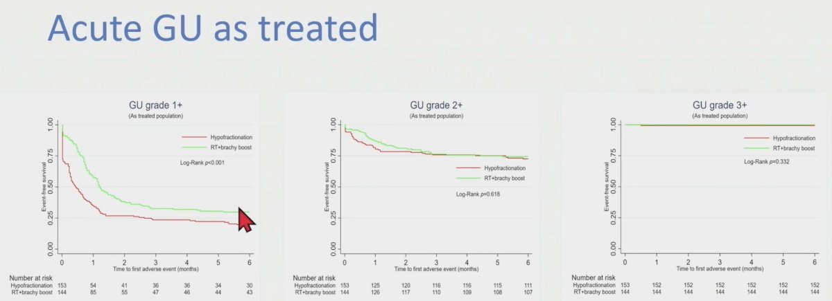 acute gu as treated