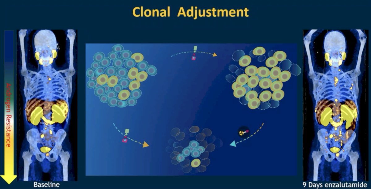 ESMO 2023: Enzalutamide and 177Lu-PSMA-617 in Poor-Risk Metastatic  Castration-Resistant Prostate Cancer (mCRPC), a Randomized, Phase 2 Trial