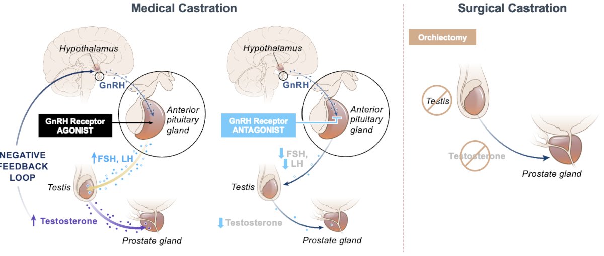 SUO 2023: Androgen Receptor Agonist versus Antagonist: Cardiac