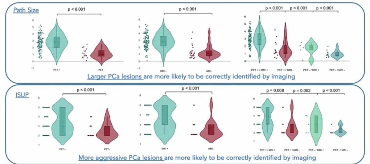 larger prostate cancer lesions and more aggressive prostate cancer lesions are more likely to be identified by imaging