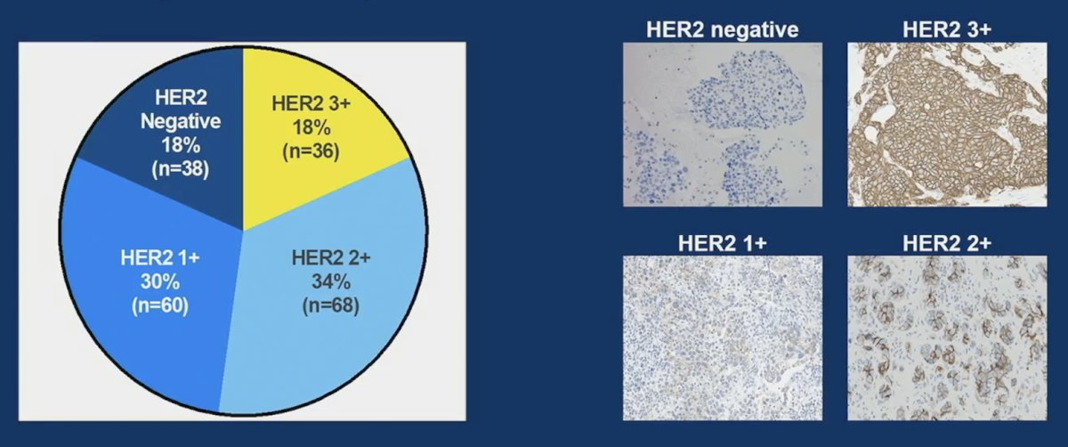 HER2 immunohistochemistry expression