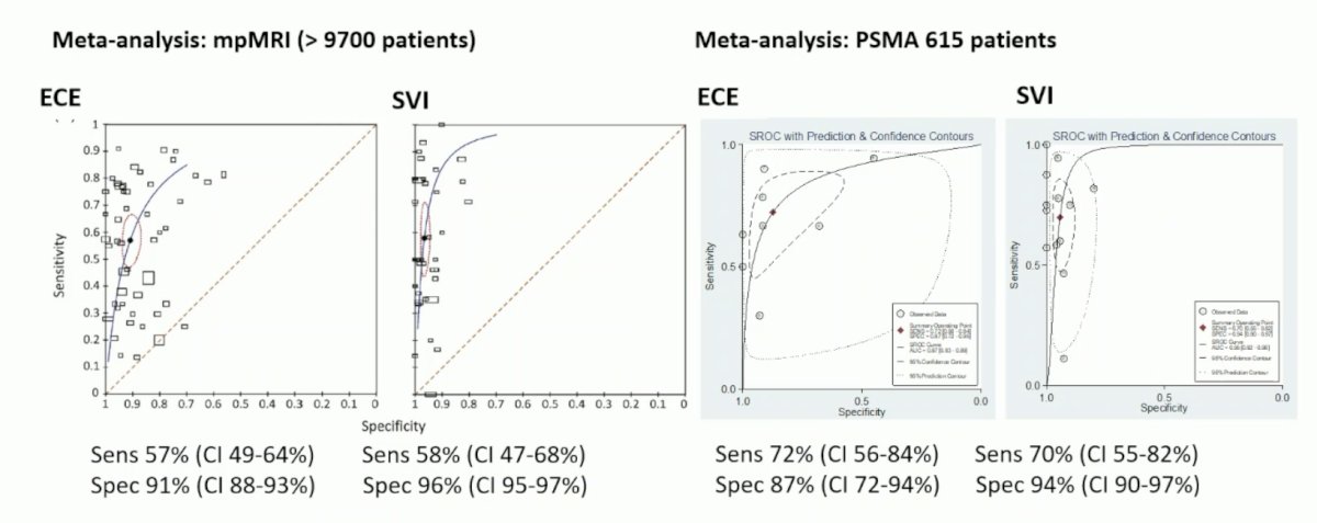 PSMA PET/CT has slightly improved sensitivity for assessing extracapsular extension and seminal vesicle invasion compared to MRI, with comparable specificity