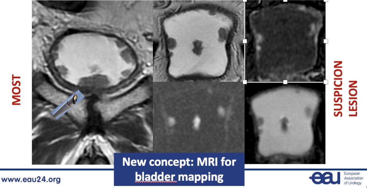imaging tool can be used to map the bladder