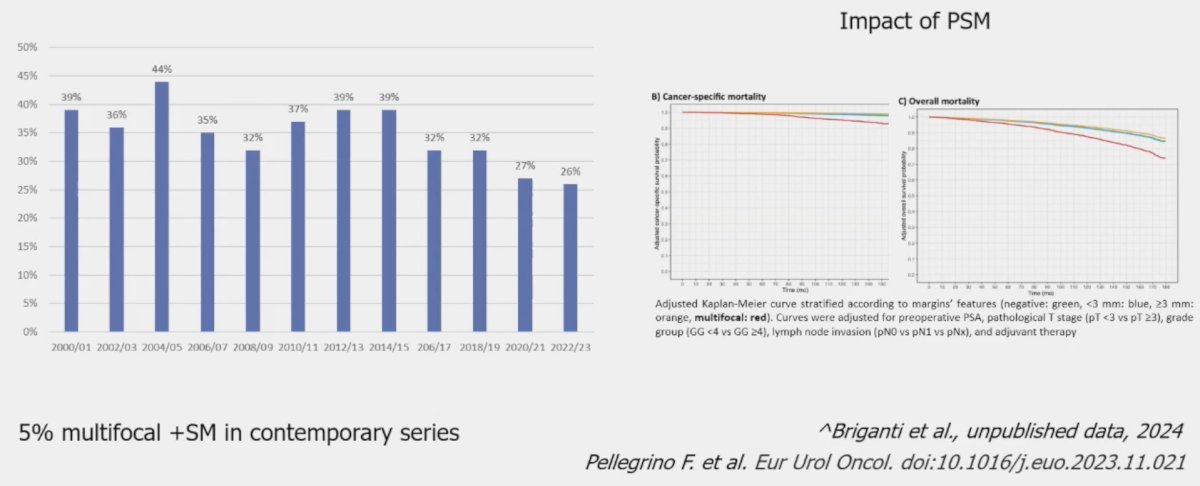 temporal reduction in positive surgical margins over more recent years in patients with high-risk/locally advanced disease