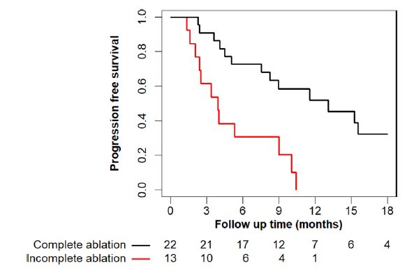 androgen receptor signaling inhibitors for oligometastatic prostate cancer, noting that complete ablation of lesions leads to improved progression free survival