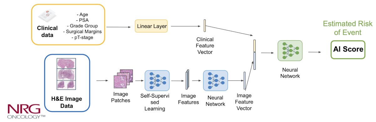 Digitized images of prostatectomy tumor samples were utilized to develop an MMAI model to predict distant metastasis utilizing image features with pathologic Grade Group, pathologic T stage, pre-salvage radiotherapy PSA, age, and surgical margin status