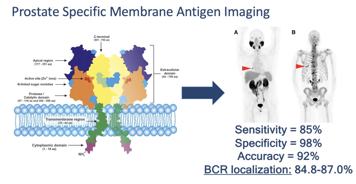 prostate specific membrane antigen imaging