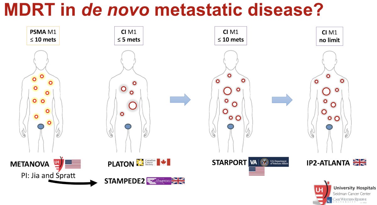 trials specifically evaluating SABR in patients with de novo metastatic disease