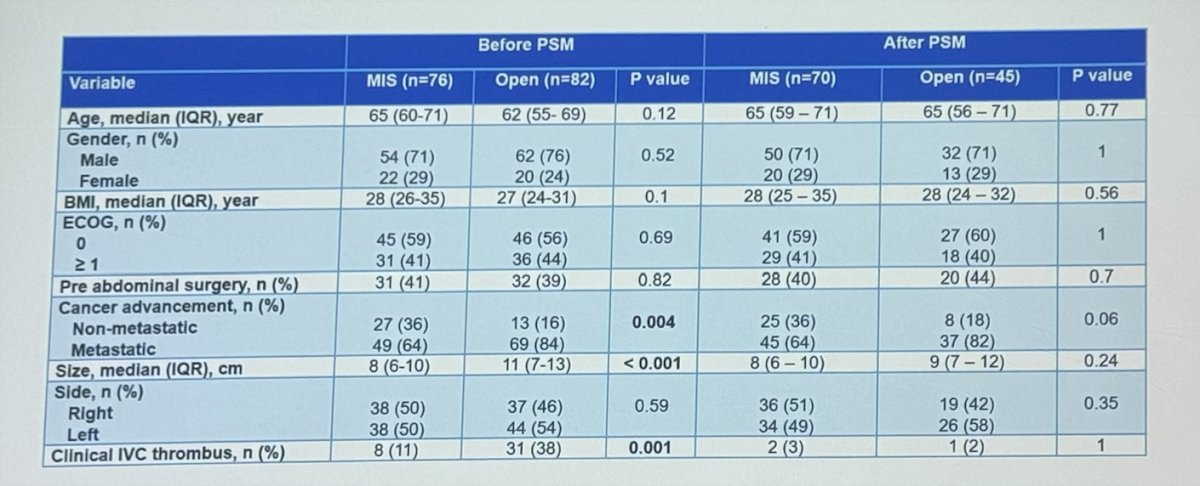 patient characteristics before and after propensity score matching, with 70 patients in the MIS group matched to 45 in the open nephrectomy group