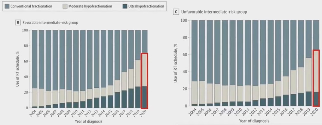 there has been an increased adoption of hypofractionated, including ultra-hypofractionated (i.e., SBRT) radiotherapy, especially following the COVID-19 pandemic