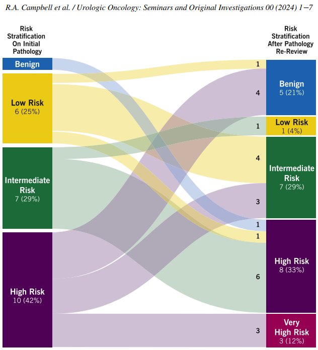 verall, 21% of patients with non-muscle invasive bladder cancer had a change in risk stratification following subspecialty re-review, include changes in grade, cT stage, and identification of histologic variants.